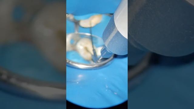 45 Подготтвка Под Ортопедию смотреть онлайн