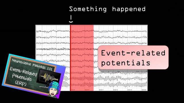 Electrocorticography (ECoG) Explained! | Neuroscience Methods 101