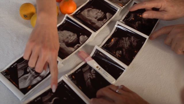 ОТЛОЖЕННОЕ МАТЕРИНСТВО | Что значит отложенное материнство и как все происходит