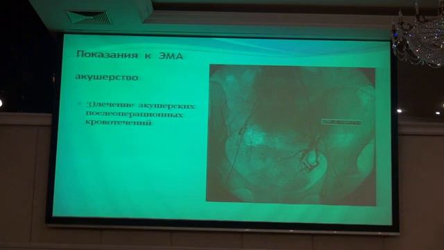 Родоразрешение при аномалиях прикрепления плаценты проф Хасанов АА смотреть онлайн