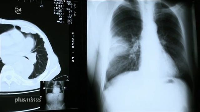 Германия: "асбестовые" дома - угроза жизни смотреть онлайн