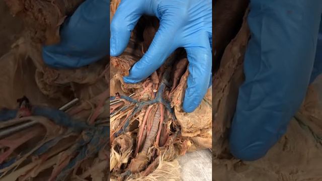 Veins смотреть онлайн