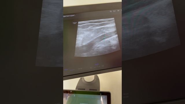 Тромбоз и флебит. Узи сосудов. Флеболог. Флеболог Москва. Сосудистый хирург смотреть онлайн