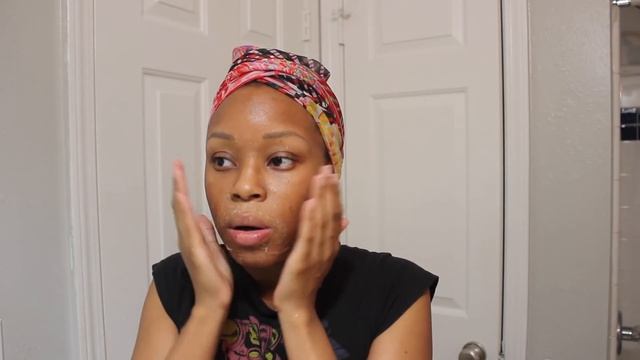 CHEMICAL PEEL EXPERIENCE | The Process, Peeling, + Before & After | No More Acne & Dark Marks! смотреть онлайн