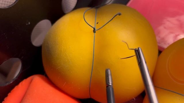 чтобы руки летали // для тех кто хочет в ипси // ипсилатеральное расположение троакров смотреть онлайн