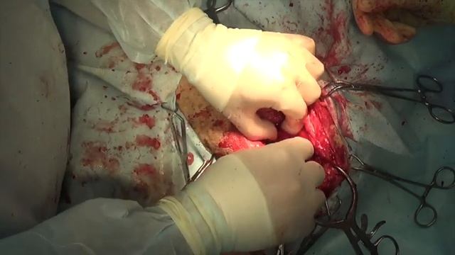 Хирургическое лечение несращения перелома бедренной кости у собаки
