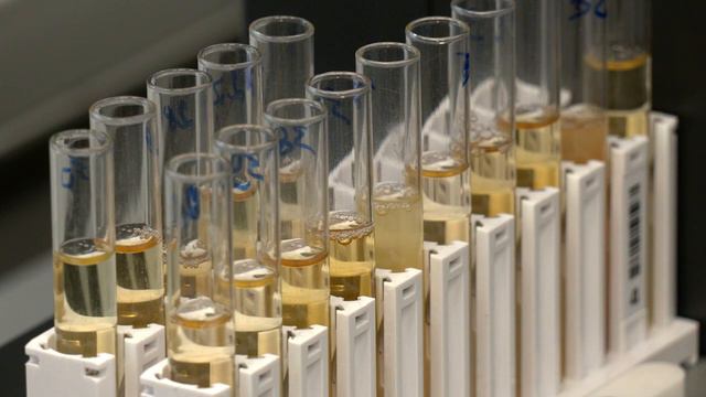 Поки їде швидка №97 ЗДАЧА ЛАБОРАТОРНИХ АНАЛІЗІВ смотреть онлайн