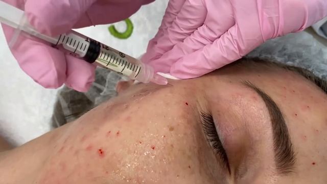 Ep.37 INNO-TDS REDNESS-ID смотреть онлайн