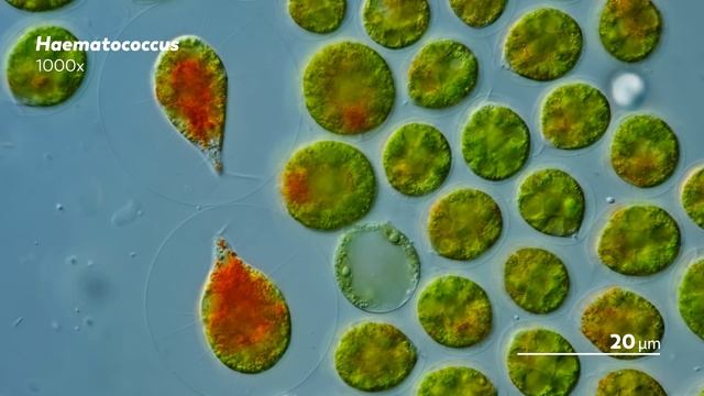 These Algae Curl Up Into a Ball When They Get Stressed Out смотреть онлайн