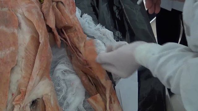 Мышцы верхней конечности на трупе смотреть онлайн