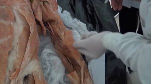 Мышцы верхней конечности на трупе