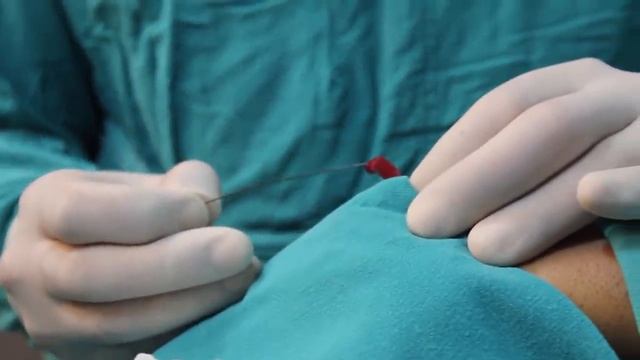 Angiography Procedure by Dr Siddhant Jain, Indore смотреть онлайн