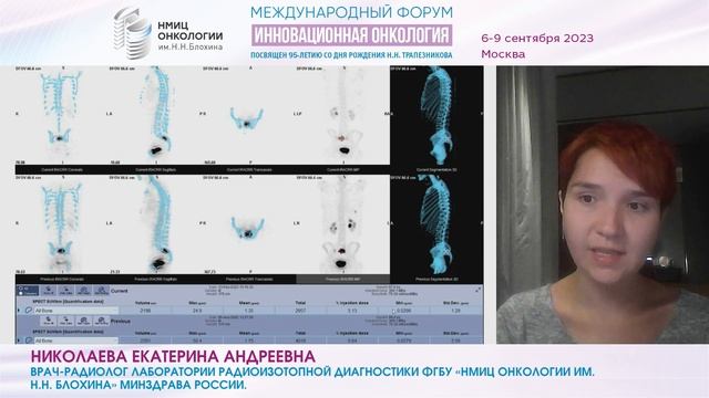 Количественная ОФЭКТ/КТ в оценке эффективности терапии дихлоридом радия-223_Николаева Е.А.