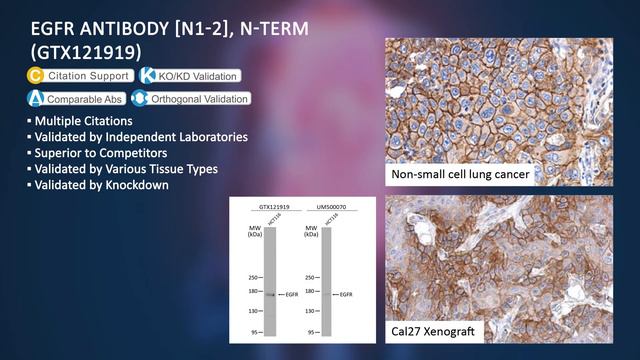 Tumor Marker Antibodies смотреть онлайн