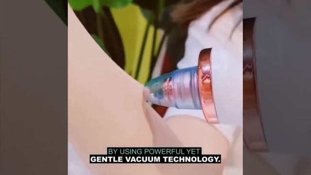 Propore™ Blackhead Vacuum And Pore Cleaner смотреть онлайн