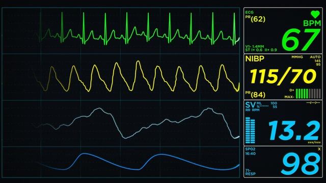 EKG Monitor Normal смотреть онлайн