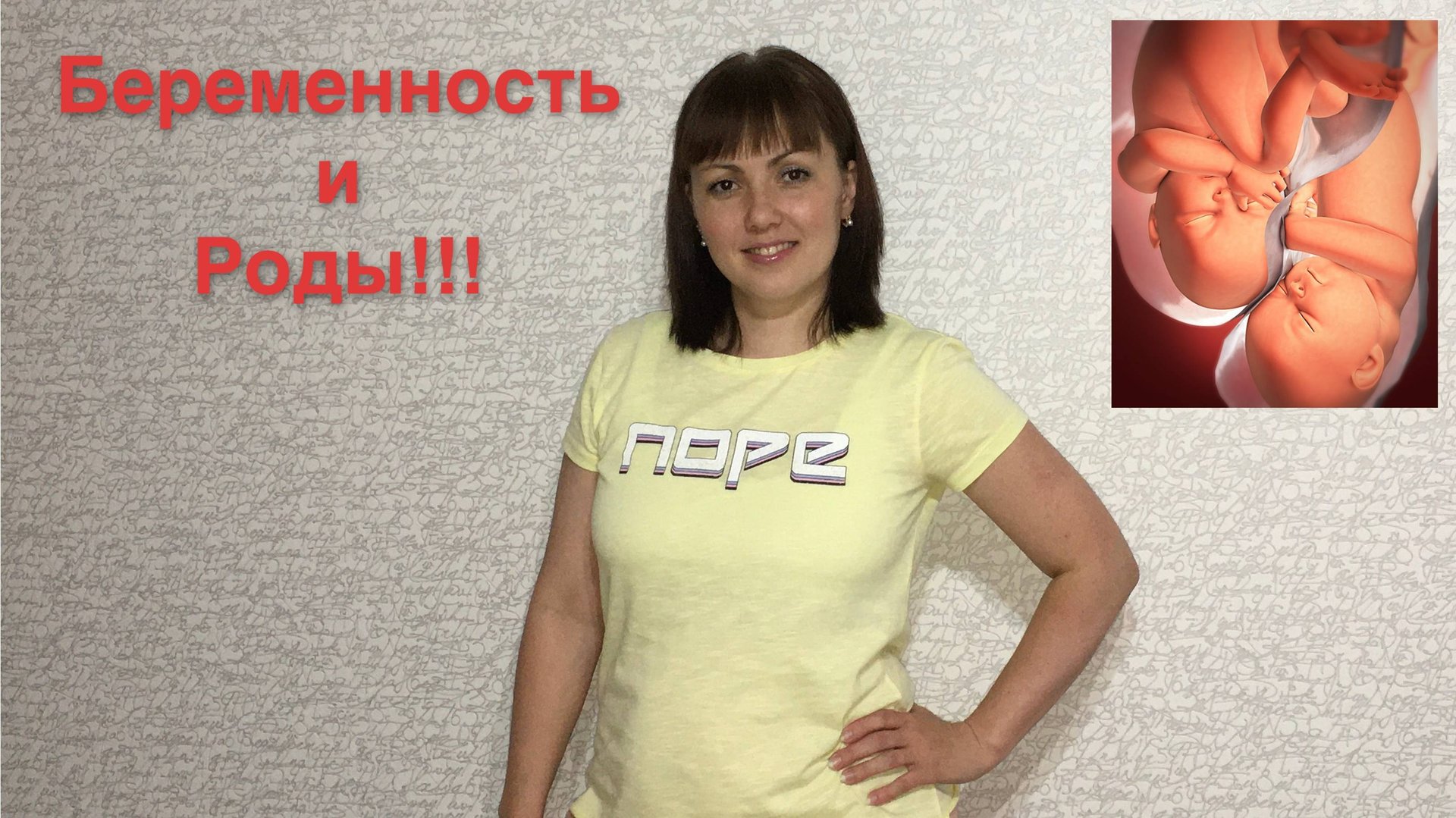 Двойня. Беременность и роды. Естественные роды двойней в 32 недели. смотреть онлайн