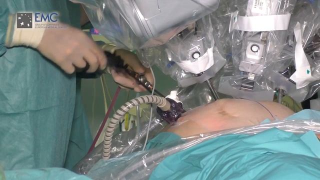 Возможности робот-ассистированной хирургии в ЕМС смотреть онлайн