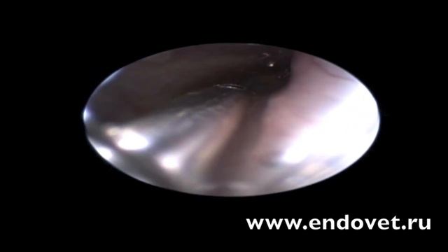 Инородное тело трахеи смотреть онлайн