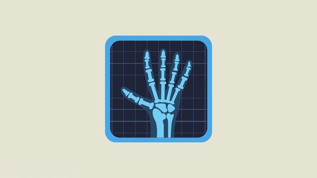 Вильгельм Рентген: Случайное Открытие Рентгеновских Лучей #рентген