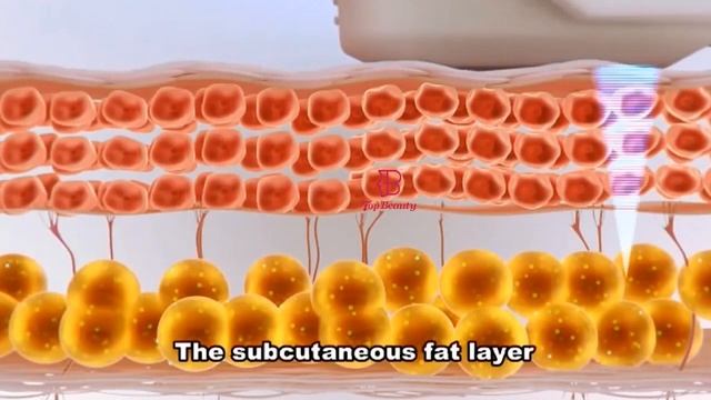 4D HIFU treatment by top beauty смотреть онлайн