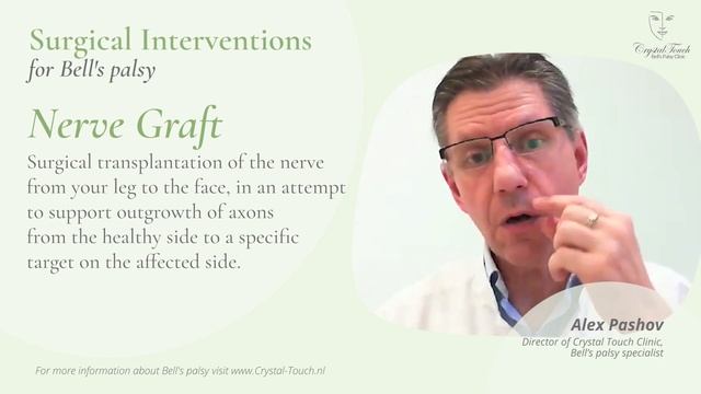 Surgical Interventions for Bell's palsy: Overview, Details and Applications смотреть онлайн