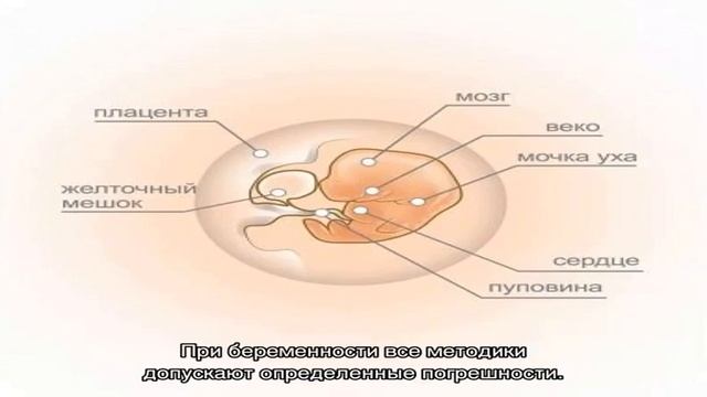 Можно ли по сердцебиению определить пол плода? смотреть онлайн