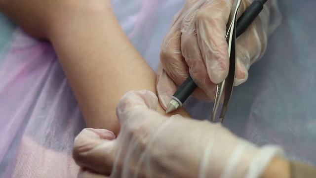 Курс Электроэпиляция в Центре МИКА. смотреть онлайн