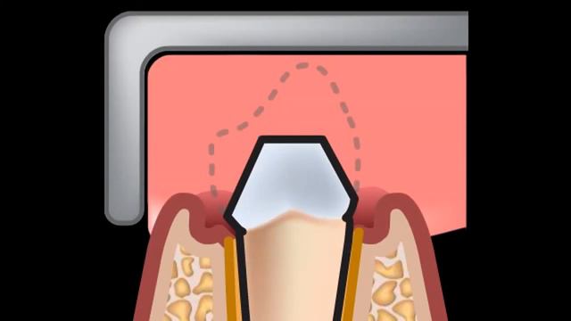 Каутер смотреть онлайн