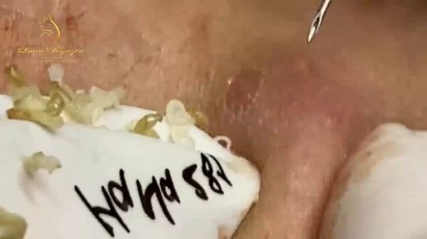 Relax Every Day With Loan Nguyen Spa TV #1011