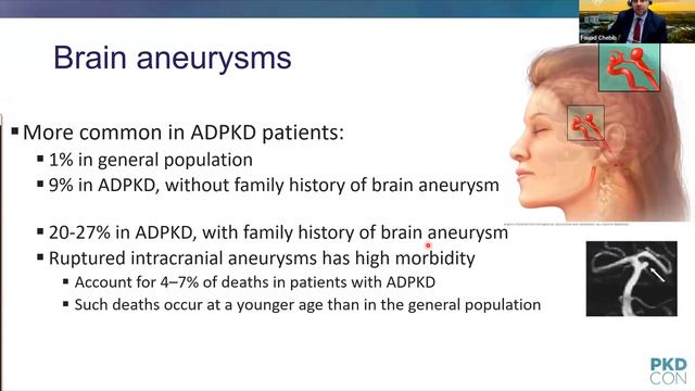 Cardiovascular Issues in ADPKD смотреть онлайн