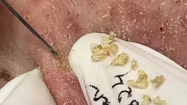 Enjoy Every Day With The Best Video Loan Nguyen Spa Beauty | 808 смотреть онлайн