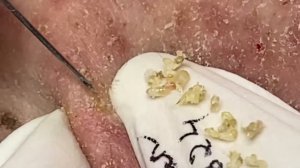 Enjoy Every Day With The Best Video Loan Nguyen Spa Beauty | 808