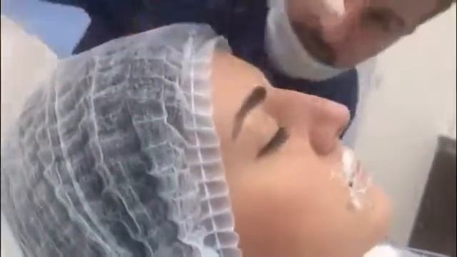 Контурная пластика носа. Прямое включение! смотреть онлайн