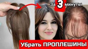 Как скрыть алопецию ? Накладка из волос на сетке теменная, инструкции от парикмахера #алопеция