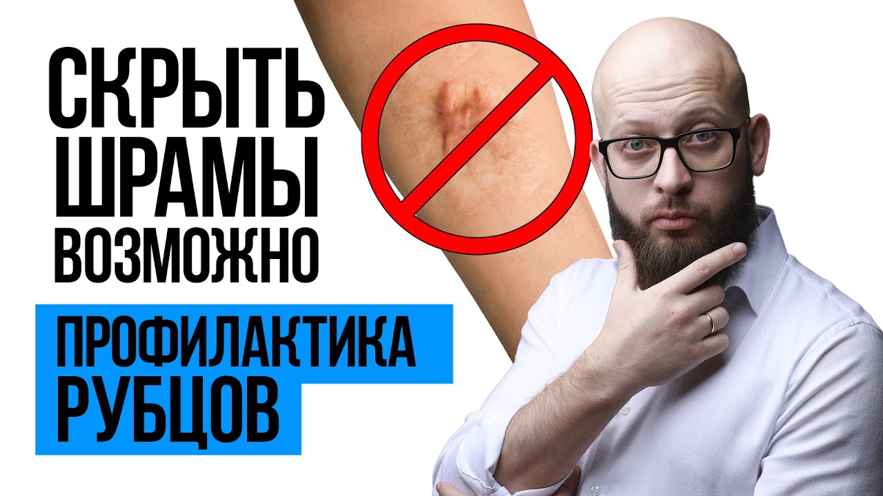Как избавиться от шрамов после операции? Виды рубцов. смотреть онлайн