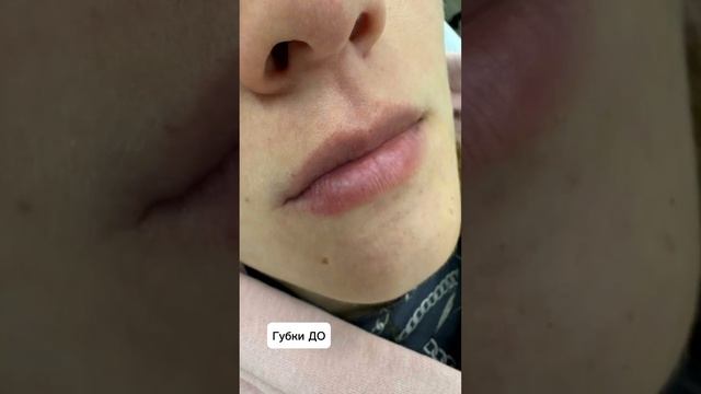 Губы мечты за 15 минут?? смотреть онлайн