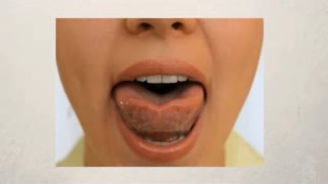 Артикуляционная гимнастика Упражнение Чашечка. Логопедическое упражнение Чашечка видео.