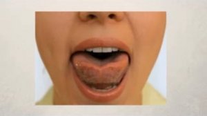 Артикуляционная гимнастика Упражнение Чашечка. Логопедическое упражнение Чашечка видео.