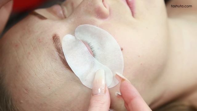 Фиксация МОРГАЮЩИХ глаз 2 популярных варианта смотреть онлайн