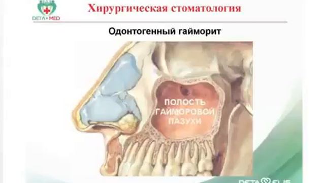 Хирургическая стоматология и Дета технологии смотреть онлайн