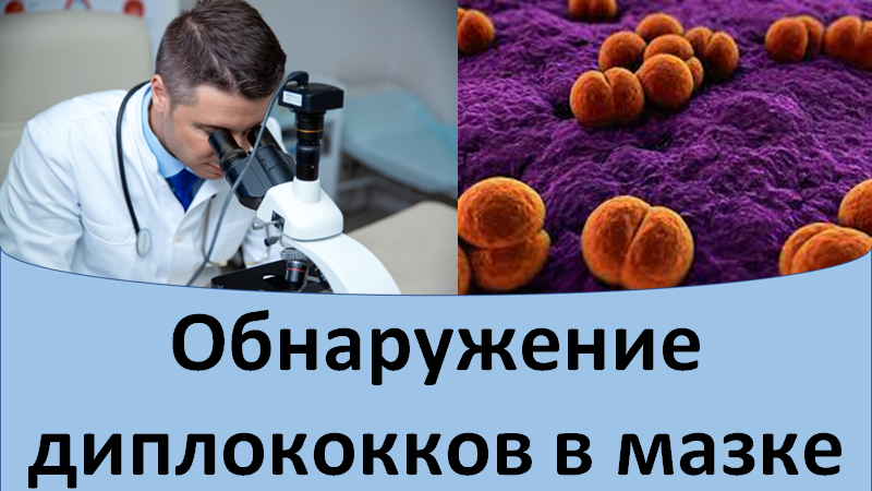 Обнаружение диплококков в мазке смотреть онлайн