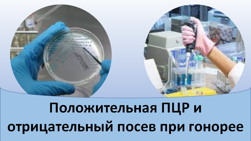 Положительная ПЦР и отрицательный посев при гонорее смотреть онлайн