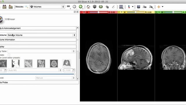 image registration in 3d slicer expert automated Affine Registration смотреть онлайн