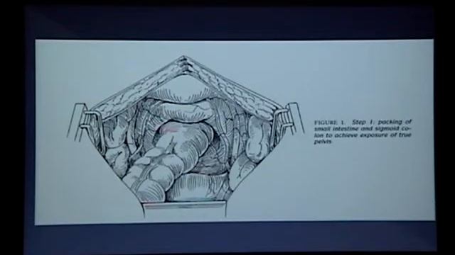 DEFECTOS DEL COMPARTIMIENTO ANTERIOR I смотреть онлайн