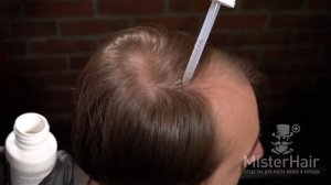 Миноксидил Киркланд 5% лосьон - способ нанесения