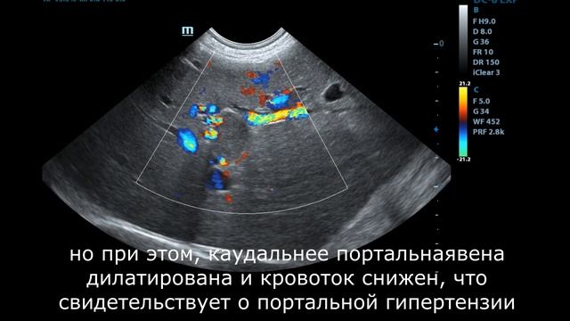 Тромбоз портальной вены у собаки смотреть онлайн