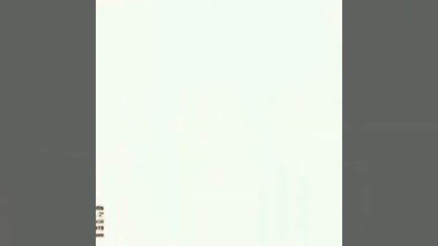 Почему нужно ставить протез когда выпал зуб смотреть онлайн