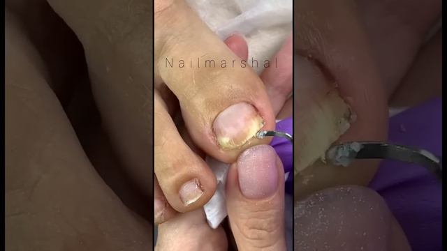 Оцени градиент в конце #pedicure #ногти #skincare #уходзакожей #pinkroyss #pinkroysscosmetics #ноги смотреть онлайн