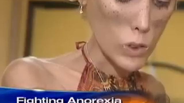 Anorexia's Childhood Roots (CBS News) смотреть онлайн
